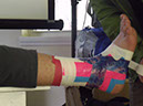 Pete%20demonstrates%20ankle%20taping